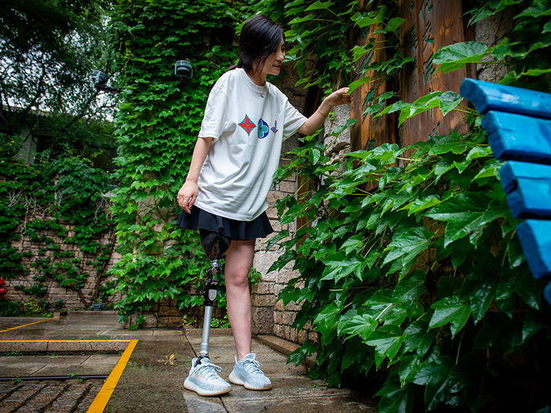 假肢案例