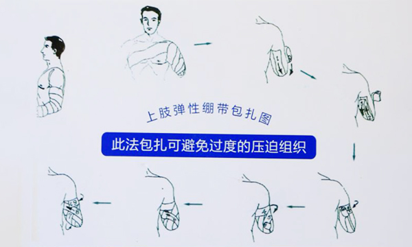 彈力繃帶包扎使用方法及注意事項(xiàng)